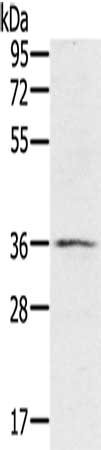 Gel: 8%SDS-PAGE, Lysate: 40 μg, Lane: TM4 cells, Primary antibody: RNF144B Antibody(RNF144B Antibody) at dilution 1/400, Secondary antibody: Goat anti rabbit IgG at 1/8000 dilution, Exposure time: 3 minutesRabbit anti-Human RNF144B Polyclonal Antibody