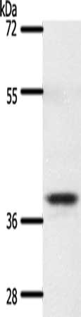 Gel: 10%SDS-PAGE, Lysate: 60 μg, Lane: Mouse thymus tissue, Primary antibody: SSTR5 Antibody(SSTR5 Antibody) at dilution 1/350, Secondary antibody: Goat anti rabbit IgG at 1/8000 dilution, Exposure time: 20 secondsRabbit anti-Human SSTR5 Polyclonal Antibody