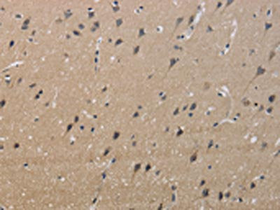 The image on the left is immunohistochemistry of paraffin-embedded Human brain  tissue using KCNMB4 Antibody(KCNMB4 Antibody) at dilution 1/40, on the right is treated with synthetic peptide. (Original magnification: ×200)Rabbit anti-Human KCNMB4 Polyclonal Antibody