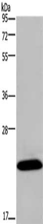 Gel: 10%SDS-PAGE, Lysate: 40 μg, Lane: Mouse brain tissue, Primary antibody: KCNMB4 Antibody(KCNMB4 Antibody) at dilution 1/500, Secondary antibody: Goat anti rabbit IgG at 1/8000 dilution, Exposure time: 1 minuteRabbit anti-Human KCNMB4 Polyclonal Antibody