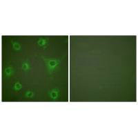 Immunofluorescence analysis of COS7 cells, using Collagen II antibody.Rabbit anti-Human COL2A1 Polyclonal Antibody