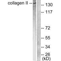 Western blot analysis of extracts from COLO205 cells, using Collagen II antibody.Rabbit anti-Human COL2A1 Polyclonal Antibody