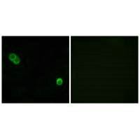 Immunofluorescence analysis of MCF-7 cells, using PHCA antibody.