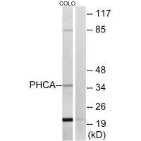 Western blot analysis of extracts from COLO cells, using PHCA antibody.