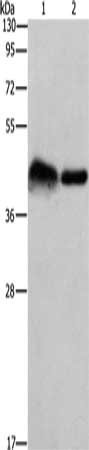 Gel: 10%SDS-PAGE, Lysate: 40 μg, Lane 1-2: Mouse bladder tissue, 293T cells, Primary antibody: CRELD1 Antibody(CRELD1 Antibody) at dilution 1/930, Secondary antibody: Goat anti rabbit IgG at 1/8000 dilution, Exposure time: 5 minutesRabbit anti-Human CRELD1 Polyclonal Antibody