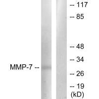 Western blot analysis of extracts from COS7 cells, using MMP-7 antibody.Rabbit anti-Human MMP7 Polyclonal Antibody