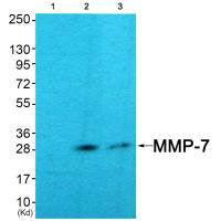 Western blot analysis of extracts from COS7  cells (Lane 2) and HuvEc cells (Lane 3), using MMP-7 antiobdy. The lane on the left is treated with systhesized peptide.Rabbit anti-Human MMP7 Polyclonal Antibody