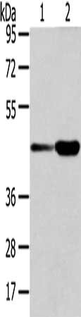 Gel: 8%SDS-PAGE, Lysate: 40 μg, Lane 1-2: Human bladder carcinoma and fetal liver tissue, Primary antibody: VPS37A Antibody(VPS37A Antibody) at dilution 1/300 dilution, Secondary antibody: Goat anti rabbit IgG at 1/8000 dilution, Exposure time: 15 secondsRabbit anti-Human VPS37A Polyclonal Antibody