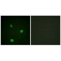 Immunofluorescence analysis of HeLa cells, using MITF (Ab-180/73) antibody.Rabbit anti-Human MITF Polyclonal Antibody