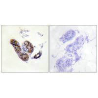 Immunohistochemistry analysis of paraffin-embedded human skin tissue using MITF (Ab-180/73) antibody.