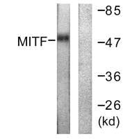 Western blot analysis of extracts from HepG2 cells (lane 1) and COLO205 cells (lane 2), using MITF (Ab-180/73) antibody.Rabbit anti-Human MITF Polyclonal Antibody