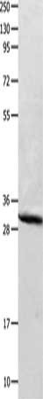Gel: 10+12%SDS-PAGE, Lysate: 40 μg, Lane: Mouse brain tissue, Primary antibody: CA2 Antibody(CA2 Antibody) at dilution 1/300, Secondary antibody: Goat anti rabbit IgG at 1/8000 dilution, Exposure time: 1 second