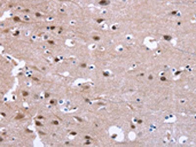 The image on the left is immunohistochemistry of paraffin-embedded Human brain tissue using the antibody Antibody) at dilution 1/25, on the right is treated with synthetic peptide. (Original magnification: ×200)