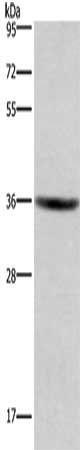 Gel: 8%SDS-PAGE, Lysate: 40 μg, Lane: HT29 cells, Primary antibody: GPR171 Antibody(GPR171 Antibody) at dilution 1/400, Secondary antibody: Goat anti rabbit IgG at 1/8000 dilution, Exposure time: 3 minutes