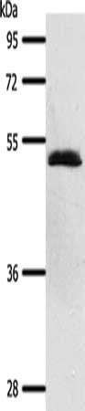 Gel: 10%SDS-PAGE, Lysate: 40 μg, Lane: Human liver cancer tissue, Primary antibody: SCTR Antibody(SCTR Antibody) at dilution 1/600, Secondary antibody: Goat anti rabbit IgG at 1/8000 dilution, Exposure time: 20 secondsRabbit anti-Human SCTR Polyclonal Antibody