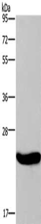 Gel: 8%SDS-PAGE, Lysate: 40μg, Lane: Human placenta tissue, Primary antibody: CRH Antibody(CRH Antibody) at dilution 1/200, Secondary antibody: Goat anti rabbit IgG at 1/8000 dilution, Exposure time: 10 secondsRabbit anti-Human CRH Polyclonal Antibody
