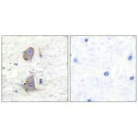 Immunohistochemical analysis of paraffin-embedded human brain tissue using GLUT1 antibody.Rabbit anti-Human SLC2A1 Polyclonal Antibody