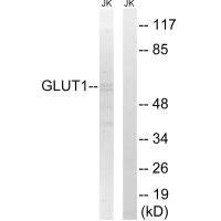 Western blot analysis of extracts from Jurkat cells, using GLUT1 antibody.Rabbit anti-Human SLC2A1 Polyclonal Antibody