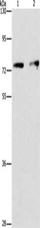 Gel: 6%SDS-PAGE, Lysate: 40 μg, Lane 1-2: Hela cells, hepG2 cells, Primary antibody: INTS10 Antibody(INTS10 Antibody) at dilution 1/475, Secondary antibody: Goat anti rabbit IgG at 1/8000 dilution, Exposure time: 1 minute