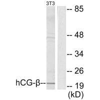 Western blot analysis of extracts from NIH/3T3 cells, using hCG β antibody.Rabbit anti-Human CGB Polyclonal Antibody