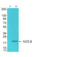Western blot analysis of extracts from K562 cells using hCG β antibody. The lane on the left is treated with synthesized peptide.Rabbit anti-Human CGB Polyclonal Antibody