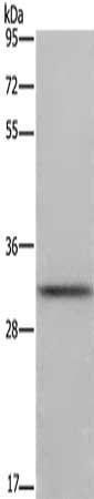 Gel: 8%SDS-PAGE, Lysate: 40 μg, Lane: Mouse brain tissue, Primary antibody: FCAR Antibody(FCAR Antibody) at dilution 1/700, Secondary antibody: Goat anti rabbit IgG at 1/8000 dilution, Exposure time: 10 secondsRabbit anti-Human FCAR Polyclonal Antibody