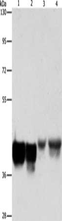 Gel: 10%SDS-PAGE, Lysate: 40 μg, Lane 1-4: Hela cells, 293T cells, mouse liver tissue, NIH/3T3 cells, Primary antibody: AUP1 Antibody(AUP1 Antibody) at dilution 1/500, Secondary antibody: Goat anti rabbit IgG at 1/8000 dilution, Exposure time: 30 seconds