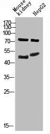 Western Blot analysis of mouse-kidney, hepg2 cells using Antibody diluted at 800. Secondary antibody  was diluted at 1:20000Rabbit anti-Human TMPO/TMPO Polyclonal Antibody