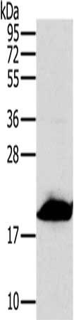 Gel: 10%SDS-PAGE, Lysate: 40 μg, Lane: 293T cells, Primary antibody: MRPL12 Antibody(MRPL12 Antibody) at dilution 1/300, Secondary antibody: Goat anti rabbit IgG at 1/8000 dilution, Exposure time: 5 secondsRabbit anti-Human MRPL12 Polyclonal Antibody