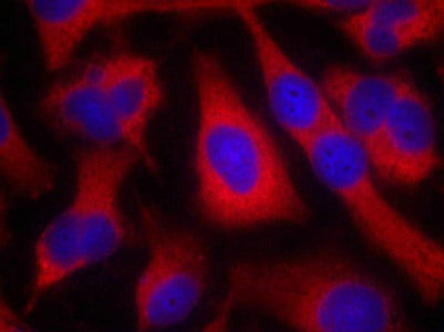 Immunofluorescence staining of methanol-fixed Hela cells using IRS-1(Ab-636) Antibody.