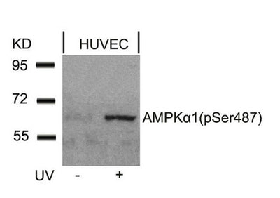 Western blot analysis of extracts from HUVEC cells untreated or treated with UV using AMPKa1(Phospho-Ser487)Antibody.Rabbit anti-Human PRKAA1/PRKAA2 Polyclonal Antibody