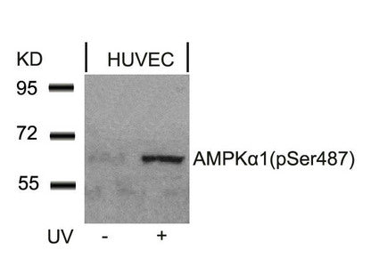 Western blot analysis of extracts from HUVEC cells untreated or treated with UV using AMPKa1(Phospho-Ser487)Antibody.Rabbit anti-Human PRKAA1/PRKAA2 Polyclonal Antibody