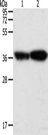 Gel: 12%SDS-PAGE, Lysate: 40 μg, Lane 1-2: Human leiomyosarcoma tissue, mouse testis tissue, Primary antibody: TPM2 Antibody(TPM2 Antibody) at dilution 1/1000, Secondary antibody: Goat anti rabbit IgG at 1/8000 dilution, Exposure time: 1 secondRabbit anti-Human TPM2 Polyclonal Antibody