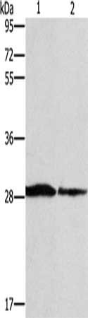 Gel: 10%SDS-PAGE, Lysate: 40 μg, Lane 1-2: Human chromaffin cell tumor tissue, lovo cells, Primary antibody: SPR Antibody(SPR Antibody) at dilution 1/1500, Secondary antibody: Goat anti rabbit IgG at 1/8000 dilution, Exposure time: 10 secondsRabbit anti-Human SPR Polyclonal Antibody