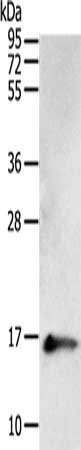 Gel: 12%SDS-PAGE, Lysate: 50 μg, Lane: Human fetal brain tissue, Primary antibody: PVALB Antibody(PVALB Antibody) at dilution 1/400, Secondary antibody: Goat anti rabbit IgG at 1/8000 dilution, Exposure time: 1 minuteRabbit anti-Human PVALB Polyclonal Antibody