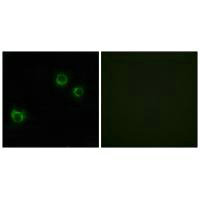 Immunofluorescence analysis of HUVEC cells, using CLDN6 antibody.Rabbit anti-Human CLDN6 Polyclonal Antibody