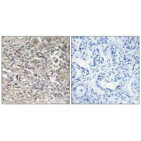 Immunohistochemistry analysis of paraffin-embedded human ovary tissue using CLDN6 antibody.Rabbit anti-Human CLDN6 Polyclonal Antibody