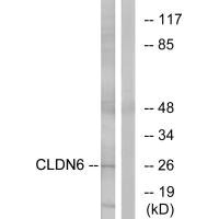 Western blot analysis of extracts from Jurkat cells, using CLDN6 antibody.Rabbit anti-Human CLDN6 Polyclonal Antibody