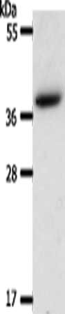 Gel: 10%SDS-PAGE, Lysate: 27 μg, Lane: Hela cells, Primary antibody: AKR1B1 Antibody(AKR1B1 Antibody) at dilution 1/550, Secondary antibody: Goat anti rabbit IgG at 1/8000 dilution, Exposure time: 1 secondRabbit anti-Human AKR1B1 Polyclonal Antibody