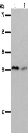 Gel: 12%SDS-PAGE, Lysate: 40 μg, Lane 1-2: Mouse brain tissue, Mouse kidney tissue, Primary antibody: KLK7 Antibody(KLK7 Antibody) at dilution 1/600, Secondary antibody: Goat anti rabbit IgG at 1/8000 dilution, Exposure time: 20 seconds