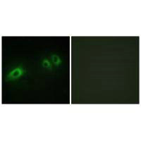 Immunofluorescence analysis of HeLa cells, using LAMB1 antibody.