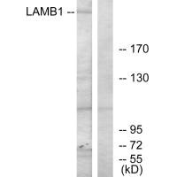 Western blot analysis of extracts from HepG2 cells, using LAMB1 antibody.