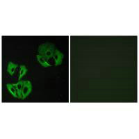 Immunofluorescence analysis of A549 cells, using MADD antibody.
