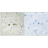 Immunohistochemistry analysis of paraffin-embedded human brain tissue using MADD antibody.