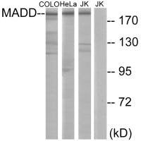 Western blot analysis of extracts from COLO cells, HeLa cells and Jurkat cells, using MADD antibody.