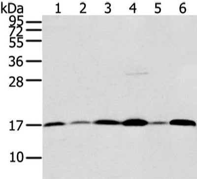 Gel: 12%SDS-PAGE, Lysate: 40 μg, Lane 1-6: Hepg2 and Jurkat cell, human fetal brain tissue and hela cell, A431 and PC3 cell, Primary antibody: UBL4A Antibody(UBL4A Antibody) at dilution 1/800 dilution, Secondary antibody: Goat anti rabbit IgG at 1/8000 dilution, Exposure time: 1 minuteRabbit anti-Human UBL4A Polyclonal Antibody