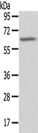 Gel: 8%SDS-PAGE,Lysate: 40 μg,,Primary antibody: SGPL1 Antibody(SGPL1 Antibody) at dilution 1/200 dilution,Secondary antibody: Goat anti rabbit IgG at 1/8000 dilution,Exposure time: 1 secondRabbit anti-Human SGPL1 Polyclonal Antibody