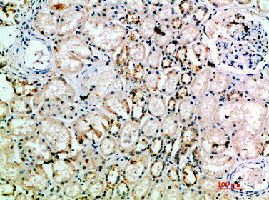 Immunohistochemical analysis of paraffin-embedded human-kidney, antibody was diluted at 1:200