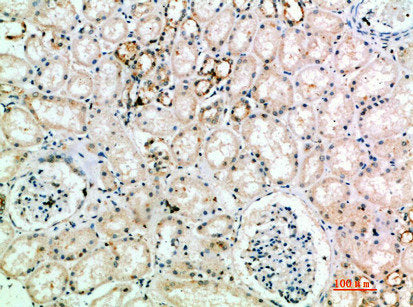 Immunohistochemical analysis of paraffin-embedded human-kidney, antibody was diluted at 1:200Rabbit anti-Human L1CAM Polyclonal Antibody