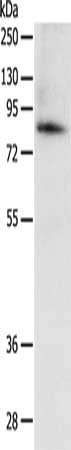 Gel: 10%SDS-PAGE, Lysate: 40 μg, Lane: A431 cells, Primary antibody: PADI4 Antibody(PADI4 Antibody) at dilution 1/150, Secondary antibody: Goat anti rabbit IgG at 1/8000 dilution, Exposure time: 10 minutesRabbit anti-Human PADI4 Polyclonal Antibody